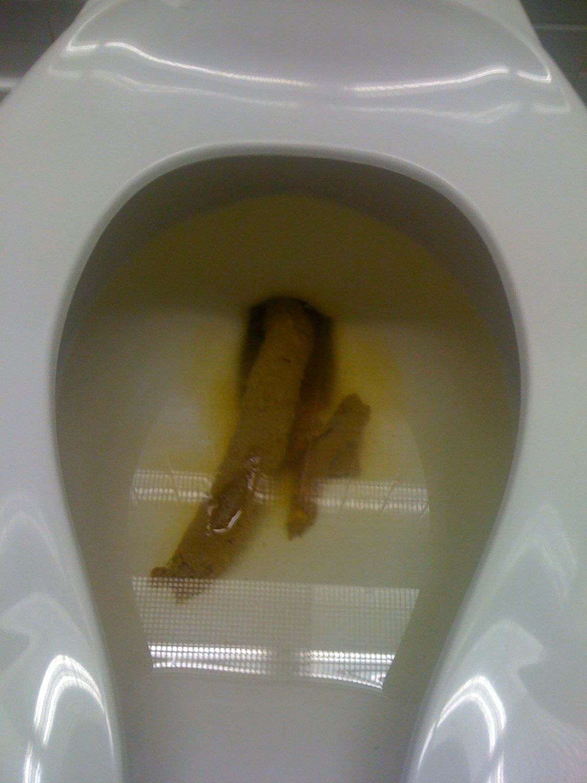 1200px-Human_Feces_Bristol_Stool_Chart_Type_4.jpg