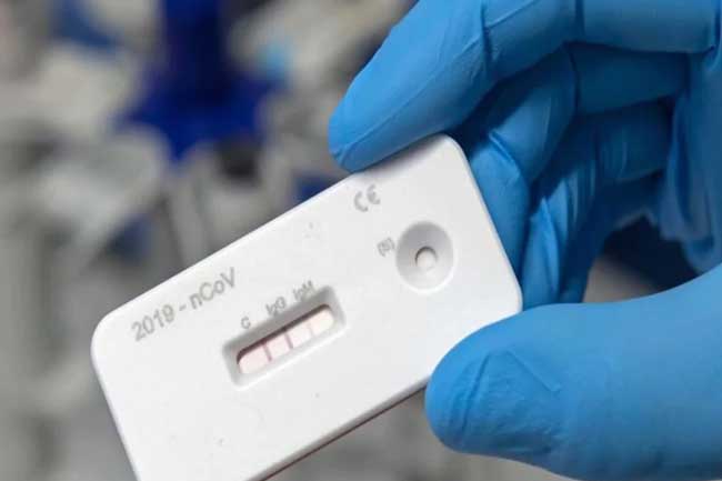 1604901123-rapid-antigen-test-kits_L.jpg