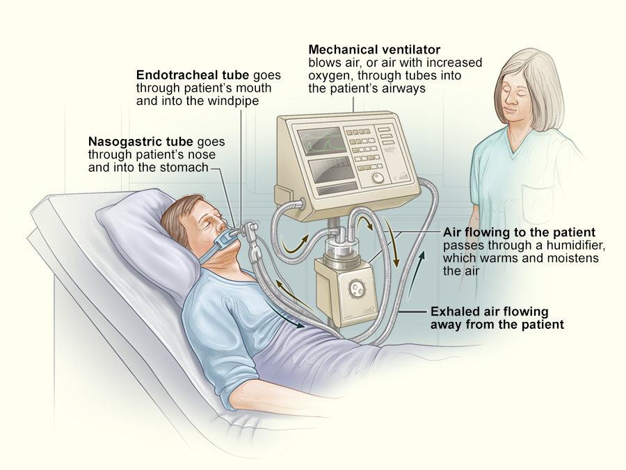 19-1096-NHLBI-OY1-Q41-ES-Ventilator-Support_900px_dev1.jpg