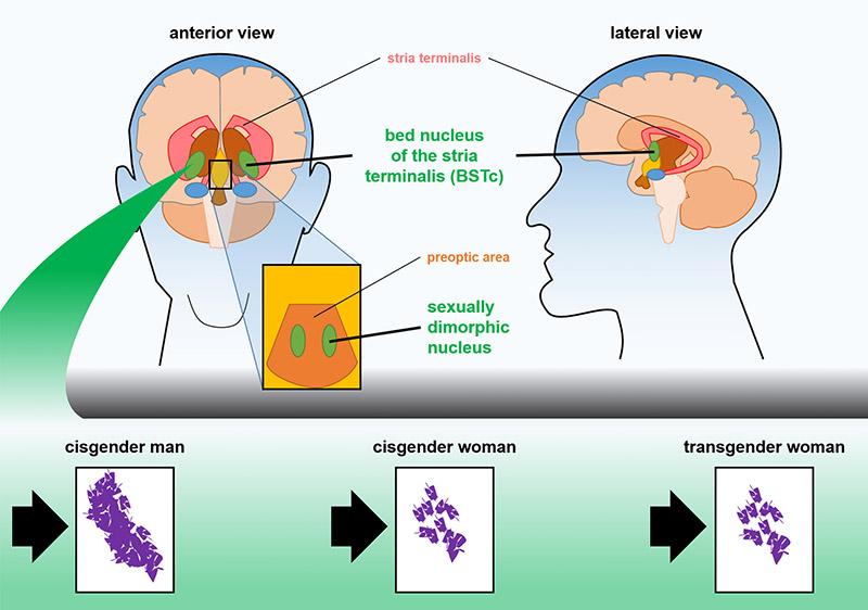 5-1-graphic-brain-trans.jpg