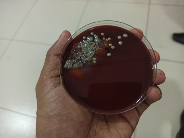 Bacterial Colony.jpg