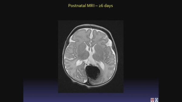 brain-image-2-jpg.jpg
