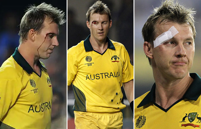 Brett-Lee-injured-in-his-eye-while-fielding-in-the-India-vs-Australia-2nd-quarter-final-World-...jpg