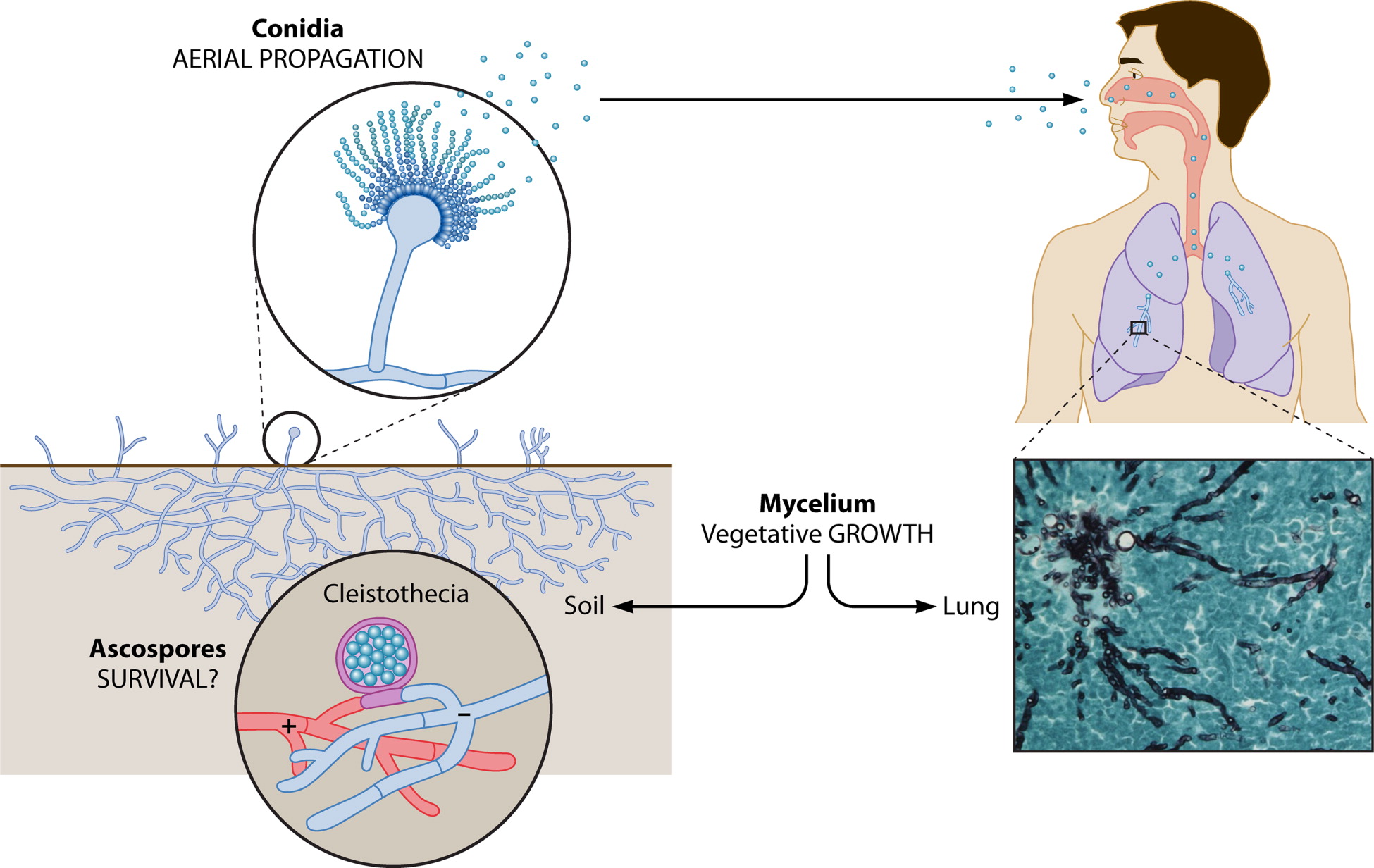Clinical Microbiology Reviews-2019-Latgé-icon-1.jpg