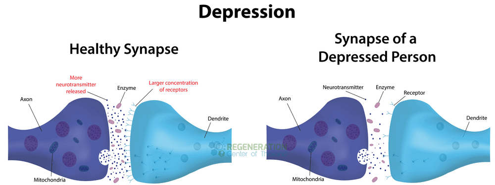 depression-neurotransmitters.png