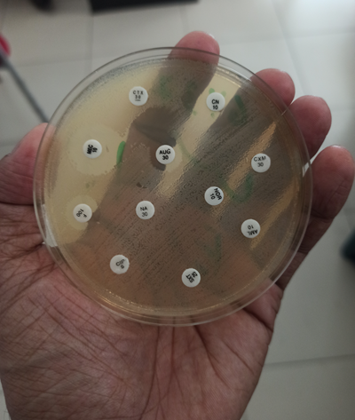 E coli 5.png