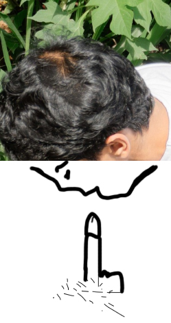 hair loss.jpg