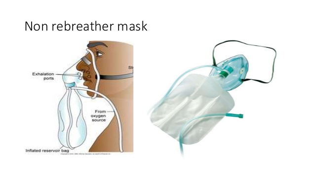 high-and-low-flow-oxygen-devices-23-638.jpg