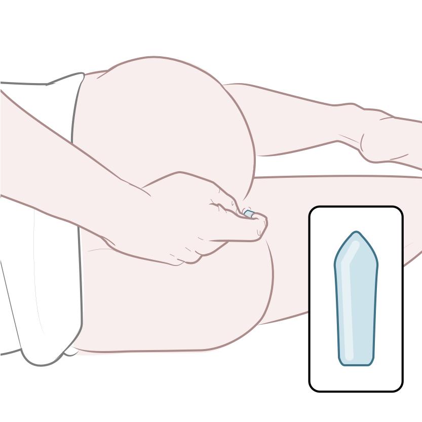inserting-suppository-rectal-suppository-series.jpg