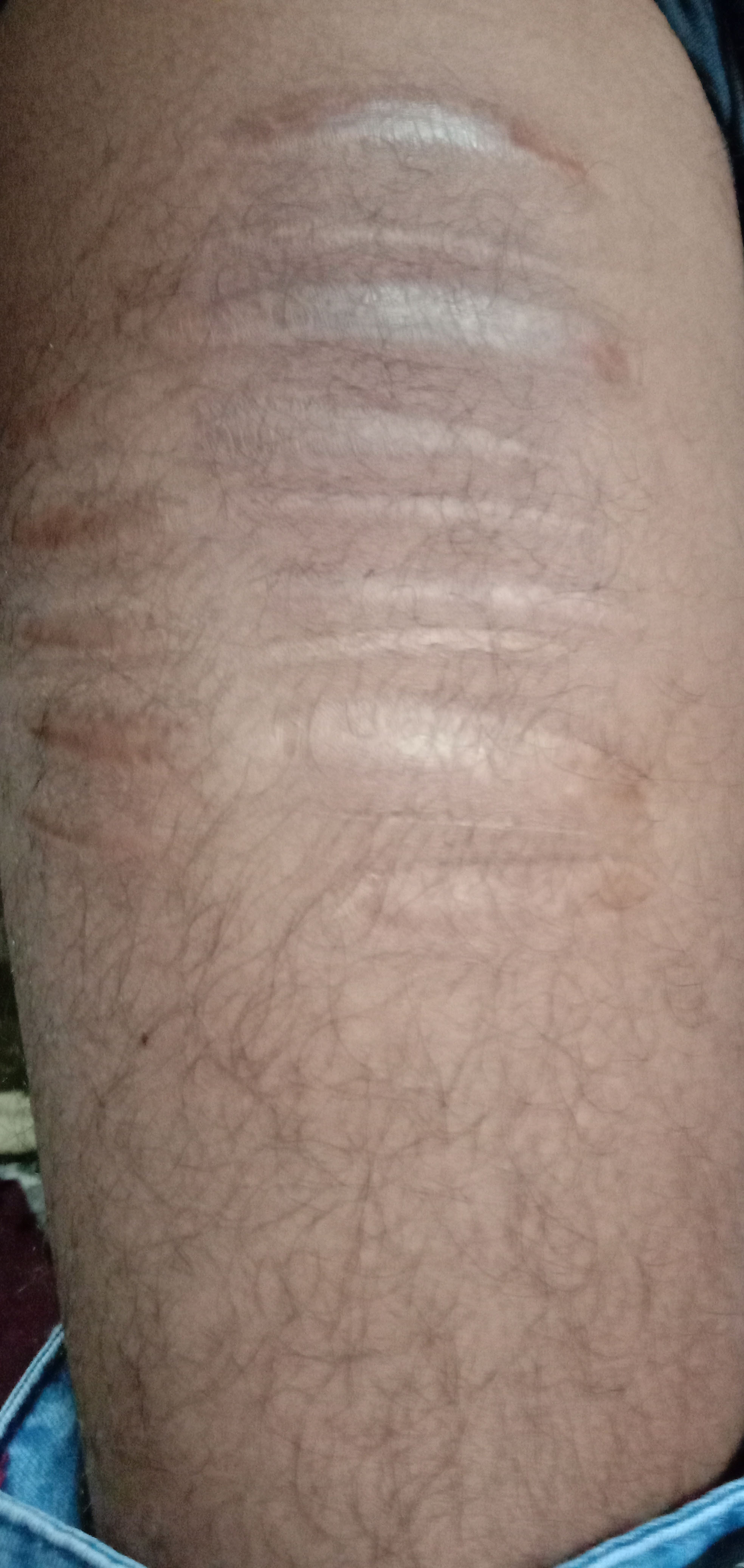 leg1.jpg