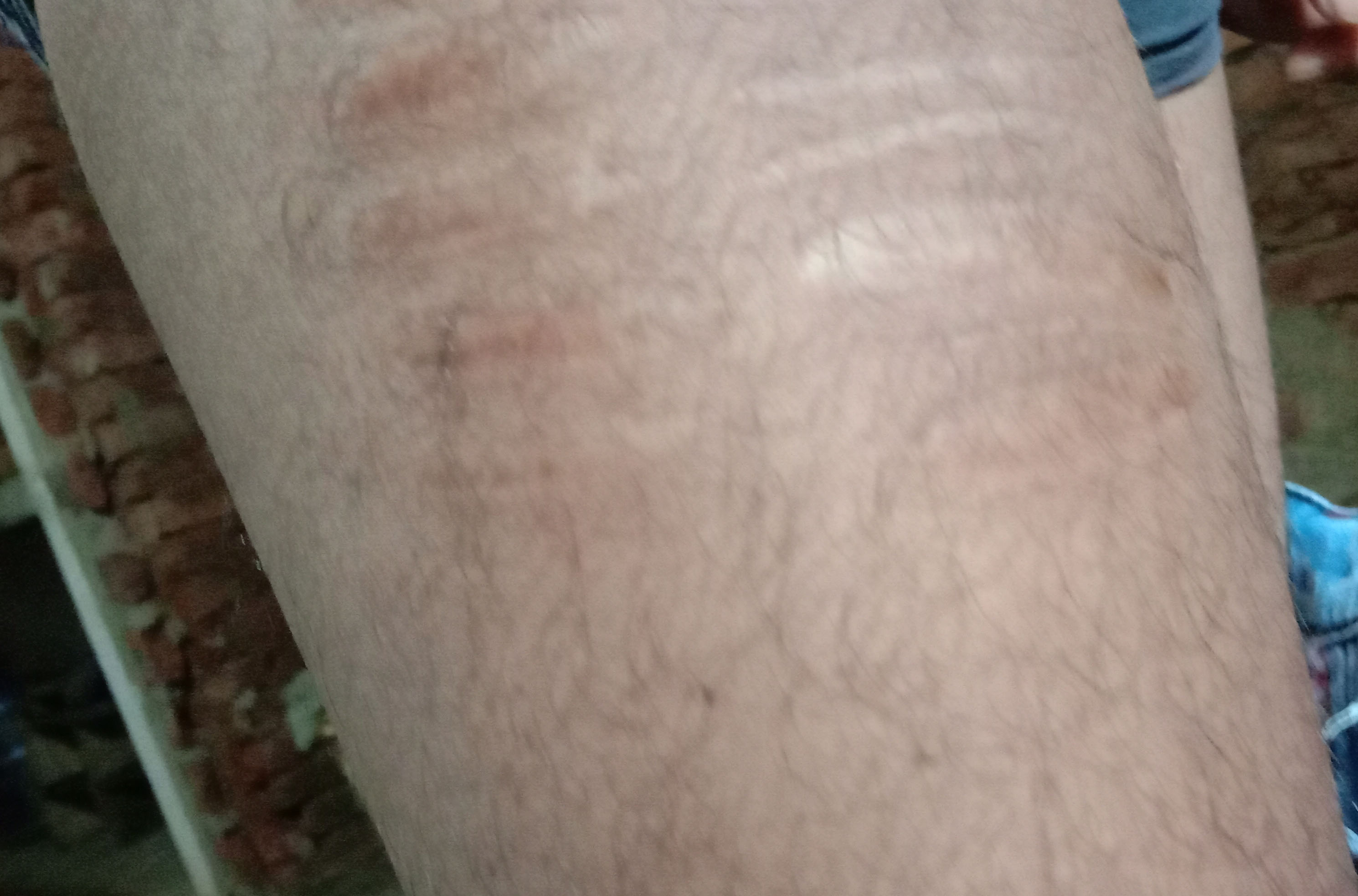 leg2.jpg