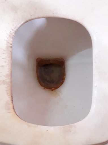 scurvy toilet.jpg