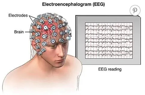 The-measurement-and-display-of-EEG-on-human-brains-with-electrodes-8.jpg