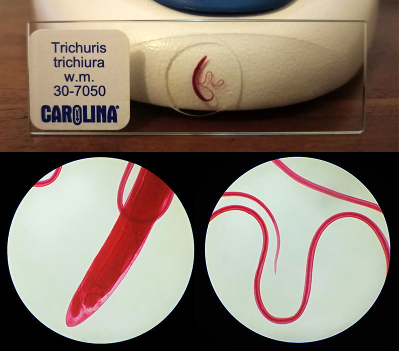 Whipworm Micro.jpg