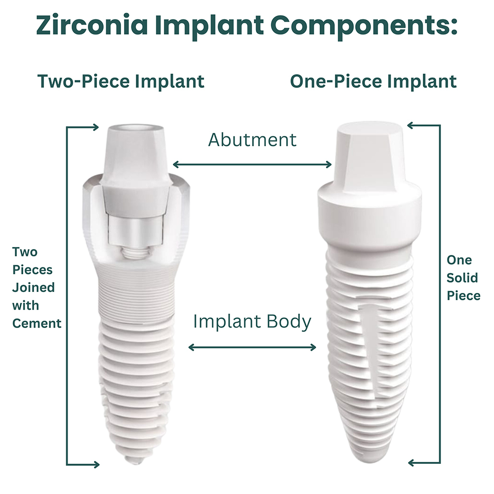 zirconia-implant-components.jpg