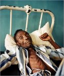 aids-patient.jpg