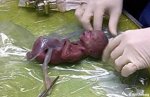 world-smallest-living-birth.jpg