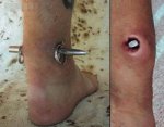 Insane-Body-Mods-18.jpg