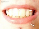 Insane-Body-Mods-27.jpg
