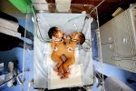 siam_twins01.jpg