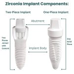 zirconia-implant-components.jpg