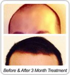 before-herbal-h8.jpg before-herbal-h8.jpg