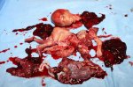 abortion-pic-2.jpg abortion-pic-2.jpg