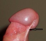Penisfrenulum.jpg Penisfrenulum.jpg