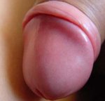 Normal penis.jpg Normal penis.jpg