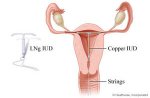 coper-t.jpg