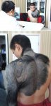 a98421_birthmark_1-zhang.jpg a98421_birthmark_1-zhang.jpg