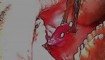 Surgery4.jpg