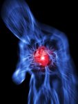 bigstock-Heart-Attack-4863606__1488439109_58.153.226.192.jpg
