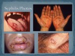 chapter-9-sexually-transmitted-diseases-4-638.jpg