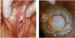 hiv aids thewoman.lk 6.jpg