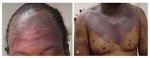 hiv aids thewoman.lk 5.jpg