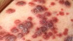 hiv aids thewoman.lk 1.jpg