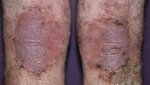 hiv aids thewoman.lk 4.jpg
