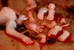 Abortion thewoman.lk.jpg