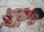 Abortion thewoman.lk2.jpg