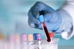 1584536587-Blood_Group_L.jpg