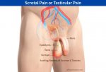 Scrotal-Pain__1534481297_58.153.198.3.jpg Scrotal-Pain__1534481297_58.153.198.3.jpg