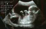 babyinwomb.jpg