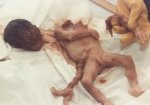 abortion-decapitated.jpg